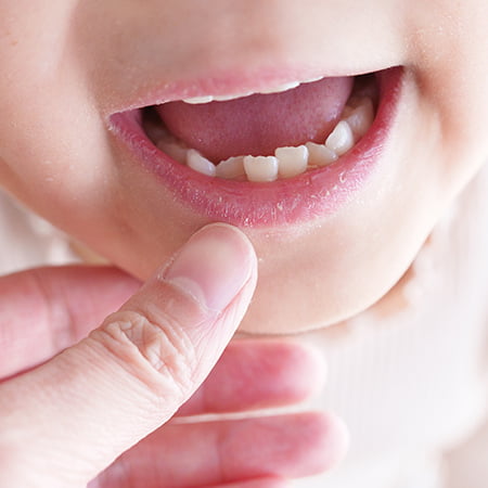 子供の歯並びがガタガタしているイメージ
