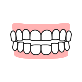 開咬のイラスト